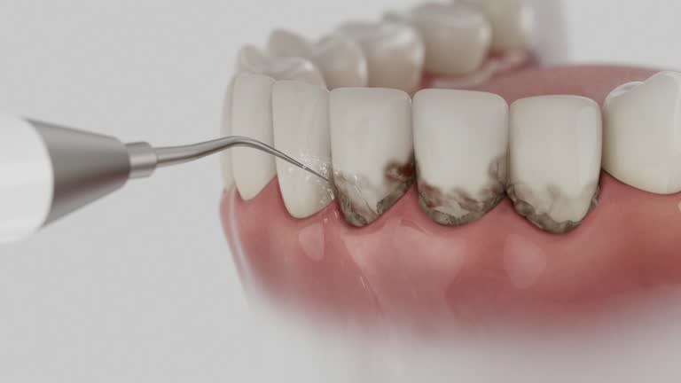 Reliable Dental contractor in Alexandria, IN by Dentist Open Now